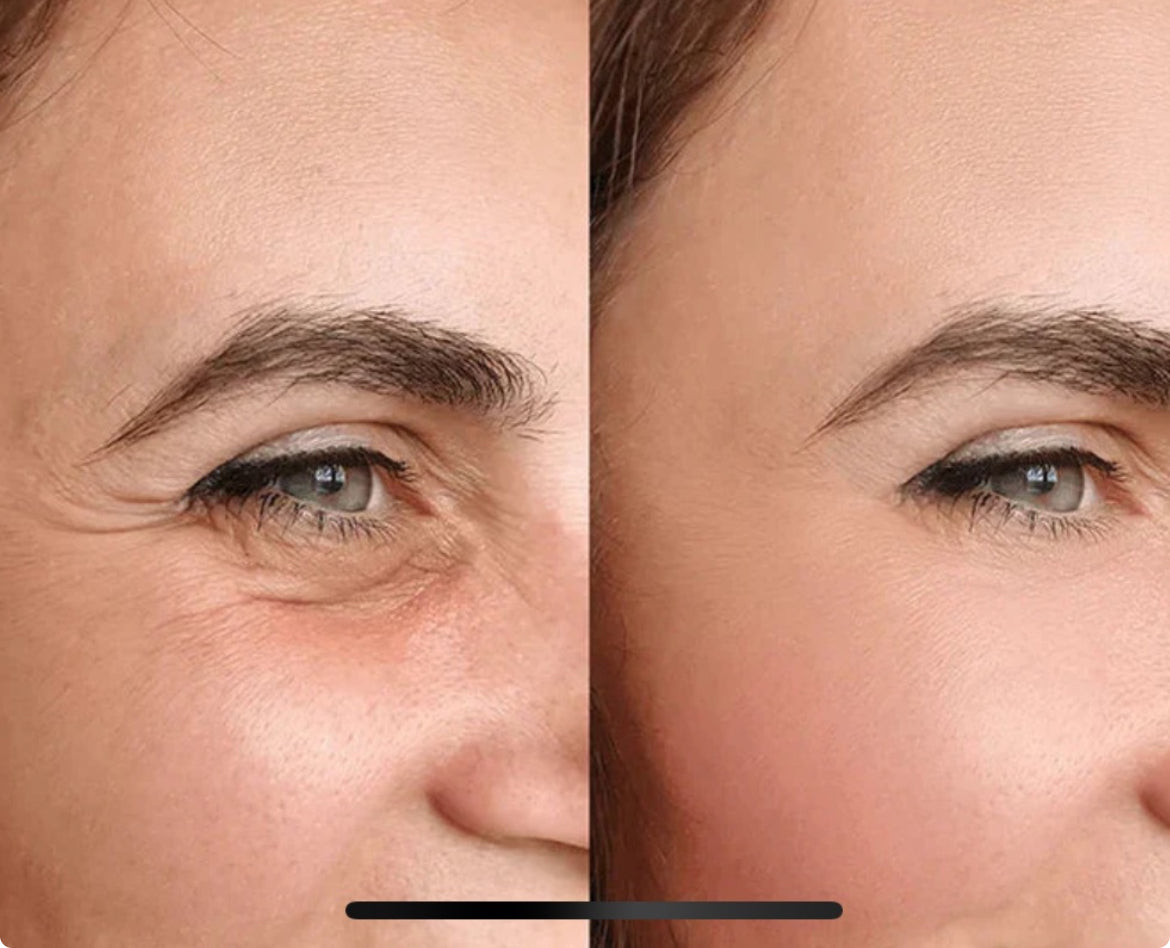 IRYNA™ Lifting : Patchs Anti-Poches et Ridules Effet Immédiat