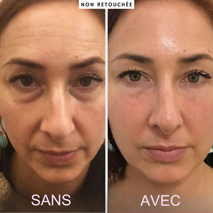 IRYNA™ Illumination: Patchs Yeux Anti-Cernes