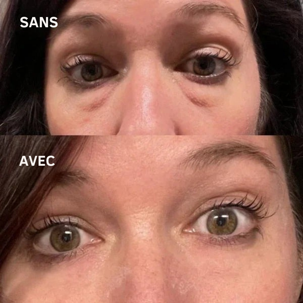 IRYNA™ Lift : Patchs Anti-Poches et Ridules Effet Immédiat