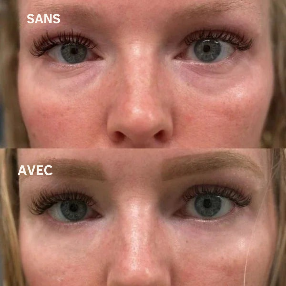 IRYNA™ Lift : Patchs Anti-Poches et Ridules Effet Immédiat