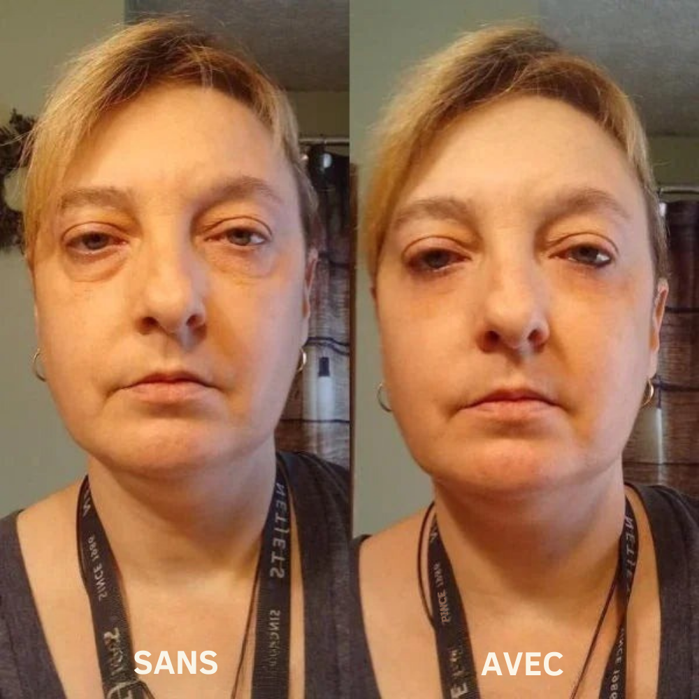 IRYNA™ Lift : Patchs Anti-Poches et Ridules Effet Immédiat
