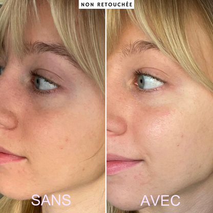 IRYNA™ Illumination: Patchs Yeux Anti-Cernes